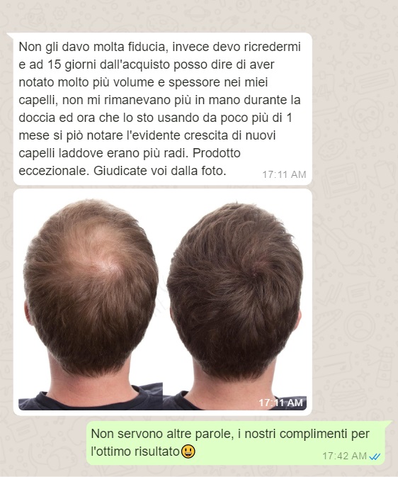 caduta capelli cause