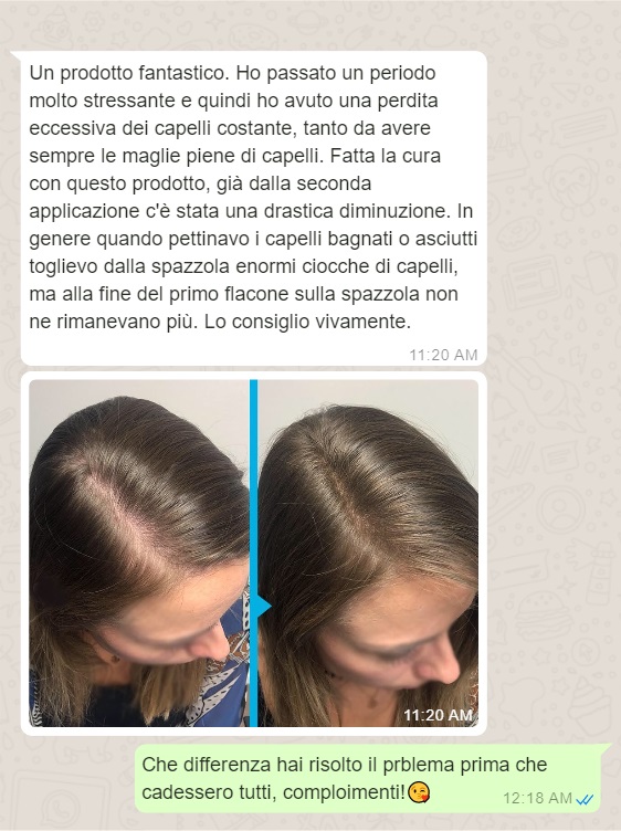 trattamento anticaduta capelli
